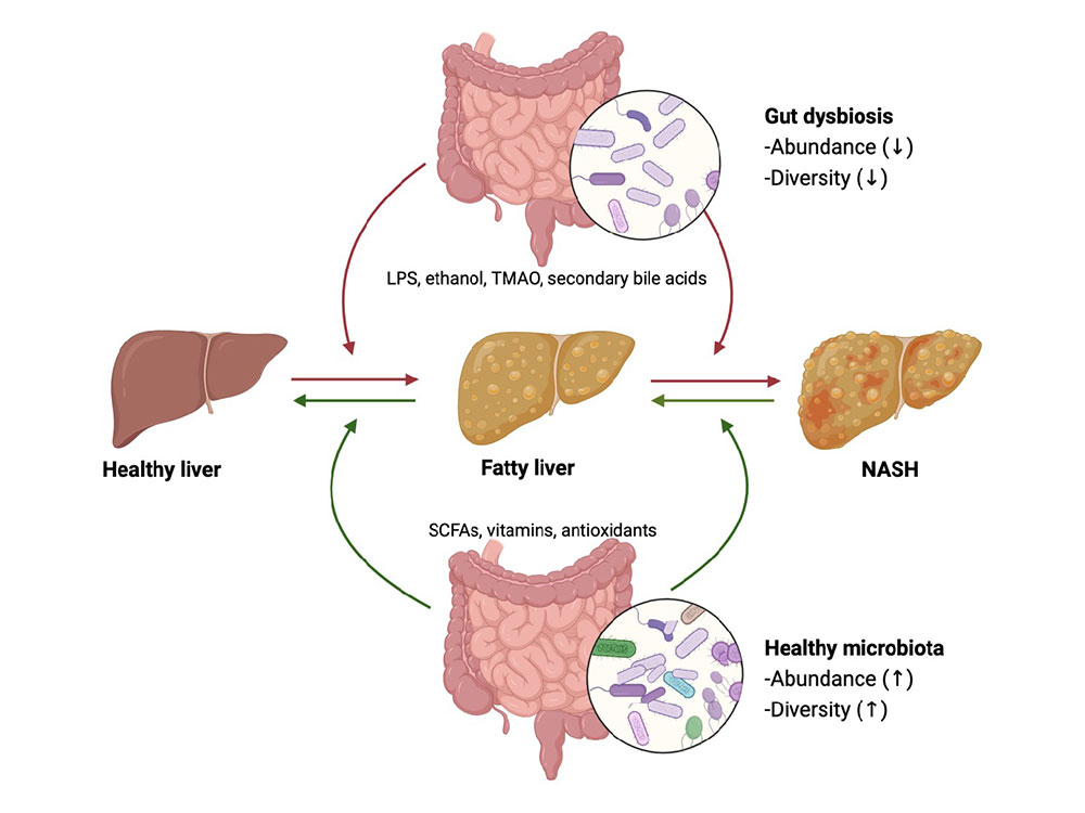 Unveiling The Role Of Gut Microbiota In Nafld Pathogenesis